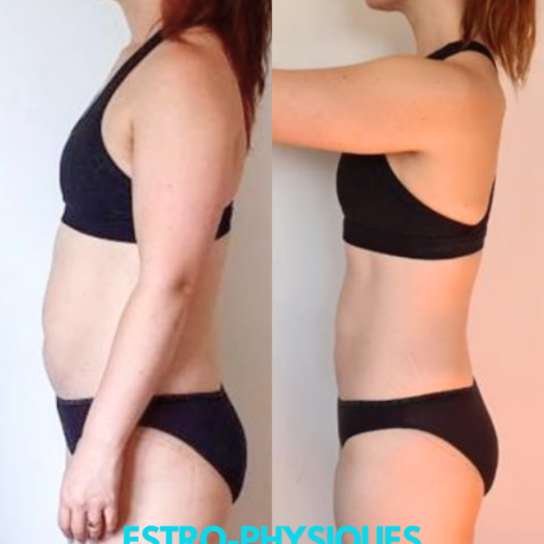 Estro Physiques client transformation