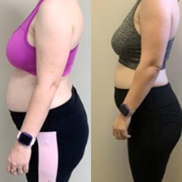Estro Physiques client transformation