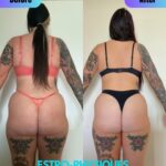 estro results 02