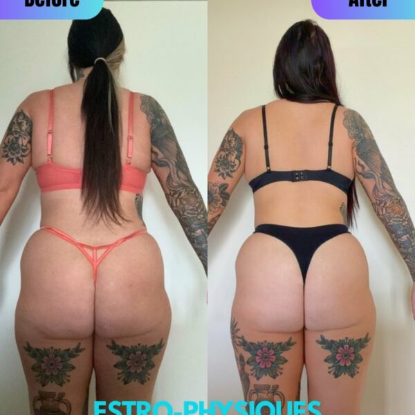 Estro Physiques client transformation